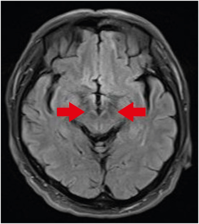 aoem-33-e6-g001.jpg