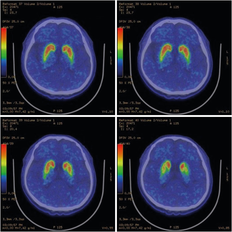 aoem-33-e6-g003.jpg